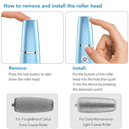 Electric Feet Callus Remover